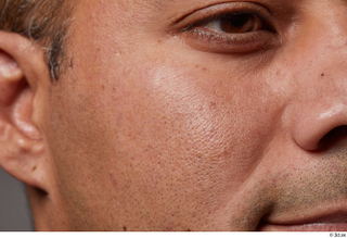 HD Face Skin Gabriel Ros cheek ear eye face skin…